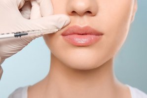 Dermal Fillers – M Health And Beauty