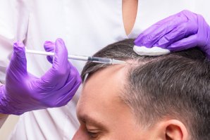  Restore Your Hair With Our Effective Hair Restoration Therapies