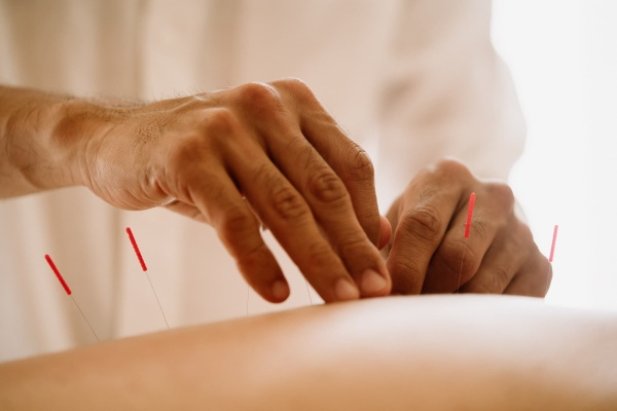Japanese Style Acupuncture Therapy - Techniques And Herbal Medicines