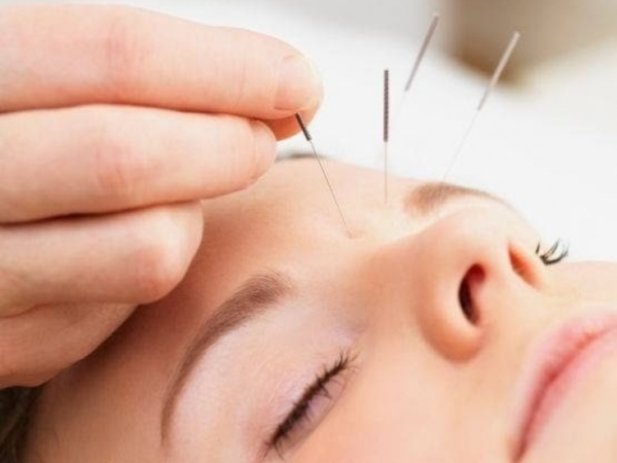 Korean-style Acupuncture Therapy – Techniques And Herbal Medications