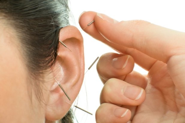 Auricular Acupuncture - Techniques And Potential To Treat Drug Addiction