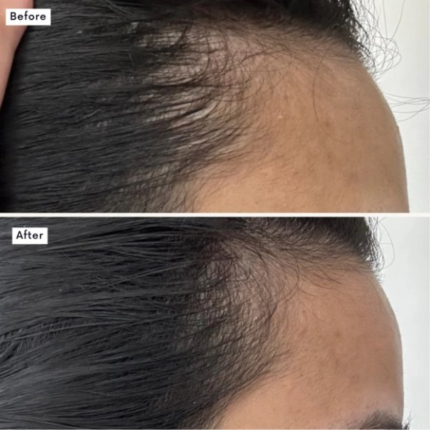 Get Longer, Fuller Hair With Hair Growth Supplement