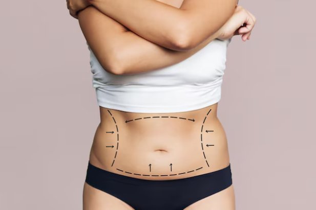 Liposuction for Body Sculpting in 2025: New Trends