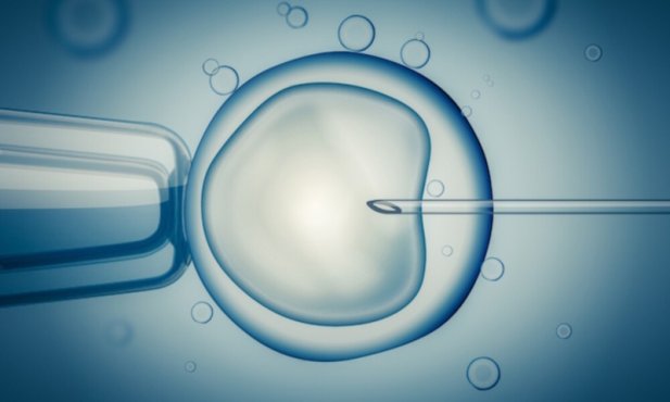 What Medical Conditions Require ICSI Instead of Standard IVF